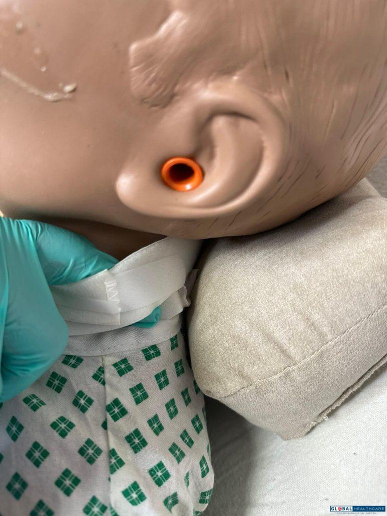 Paediatric-Tracheostomy-2023-11-773x1030